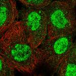 TRIM66 Polyclonal Antibody