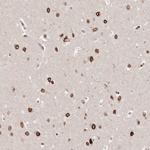 GSG2 Polyclonal Antibody