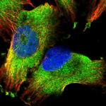 PUM1 Polyclonal Antibody