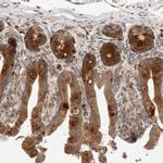 PUM1 Antibody in Immunohistochemistry (Paraffin) (IHC (P))