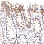 VPS45 Antibody in Immunohistochemistry (Paraffin) (IHC (P))