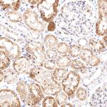 VPS45 Antibody in Immunohistochemistry (Paraffin) (IHC (P))