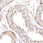 VPS45 Antibody in Immunohistochemistry (Paraffin) (IHC (P))