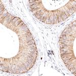 VPS45 Antibody in Immunohistochemistry (IHC)