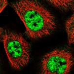 MED18 Antibody in Immunocytochemistry (ICC/IF)