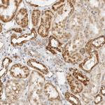 RC3H1 Antibody in Immunohistochemistry (Paraffin) (IHC (P))
