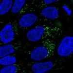 HMGCS2 Polyclonal Antibody
