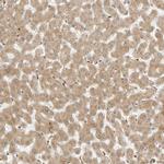 RC3H1 Antibody in Immunohistochemistry (IHC)