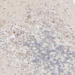 RPS6KL1 Antibody in Immunohistochemistry (IHC)