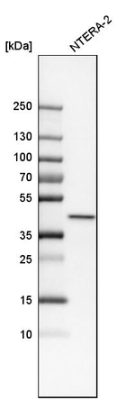 PPP1R8 Antibody in Western Blot (WB)