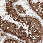 STK36 Antibody in Immunohistochemistry (IHC)