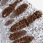 GAK Polyclonal Antibody