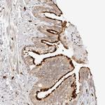 TEKT2 Polyclonal Antibody