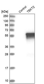 TEKT2 Antibody in Western Blot (WB)