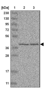UROD Antibody in Western Blot (WB)
