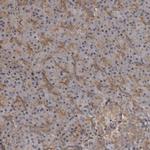 ZNRF1 Polyclonal Antibody