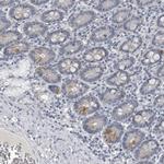 SPINK1 Antibody in Immunohistochemistry (Paraffin) (IHC (P))