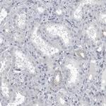 SPINK1 Antibody in Immunohistochemistry (Paraffin) (IHC (P))