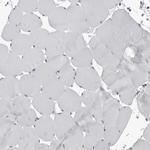 SPINK1 Antibody in Immunohistochemistry (Paraffin) (IHC (P))