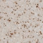 CC2D1B Polyclonal Antibody