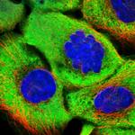 GNMT Polyclonal Antibody