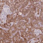 GNMT Antibody in Immunohistochemistry (Paraffin) (IHC (P))