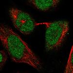 POLR3C Polyclonal Antibody