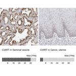 C1orf51 Polyclonal Antibody