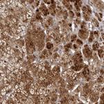 TBC1D8B Antibody in Immunohistochemistry (IHC)