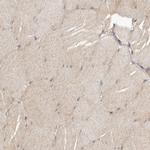 TBC1D8B Antibody in Immunohistochemistry (IHC)