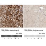TBC1D8B Antibody