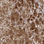 TBC1D8B Polyclonal Antibody