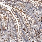 ATXN3L Antibody in Immunohistochemistry (Paraffin) (IHC (P))