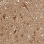 ATL1 Polyclonal Antibody