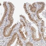 TOX4 Antibody in Immunohistochemistry (IHC)
