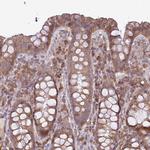 MOCS3 Polyclonal Antibody