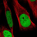 RCC1 Polyclonal Antibody