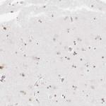 RCC1 Antibody in Immunohistochemistry (Paraffin) (IHC (P))