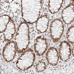RCC1 Antibody in Immunohistochemistry (Paraffin) (IHC (P))