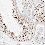 RCC1 Antibody in Immunohistochemistry (Paraffin) (IHC (P))