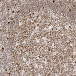 RCC1 Antibody in Immunohistochemistry (Paraffin) (IHC (P))