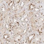 RCC1 Antibody in Immunohistochemistry (Paraffin) (IHC (P))