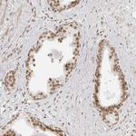 RCC1 Antibody in Immunohistochemistry (Paraffin) (IHC (P))