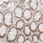 RCC1 Antibody in Immunohistochemistry (Paraffin) (IHC (P))