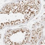 RCC1 Antibody in Immunohistochemistry (Paraffin) (IHC (P))
