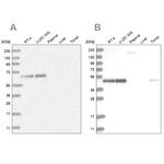 RCC1 Antibody in Western Blot (WB)