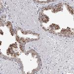 RNF220 Antibody in Immunohistochemistry (Paraffin) (IHC (P))