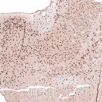 RNF220 Antibody in Immunohistochemistry (Paraffin) (IHC (P))