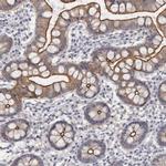 CGN Antibody in Immunohistochemistry (IHC)