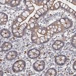 CGN Antibody in Immunohistochemistry (IHC)